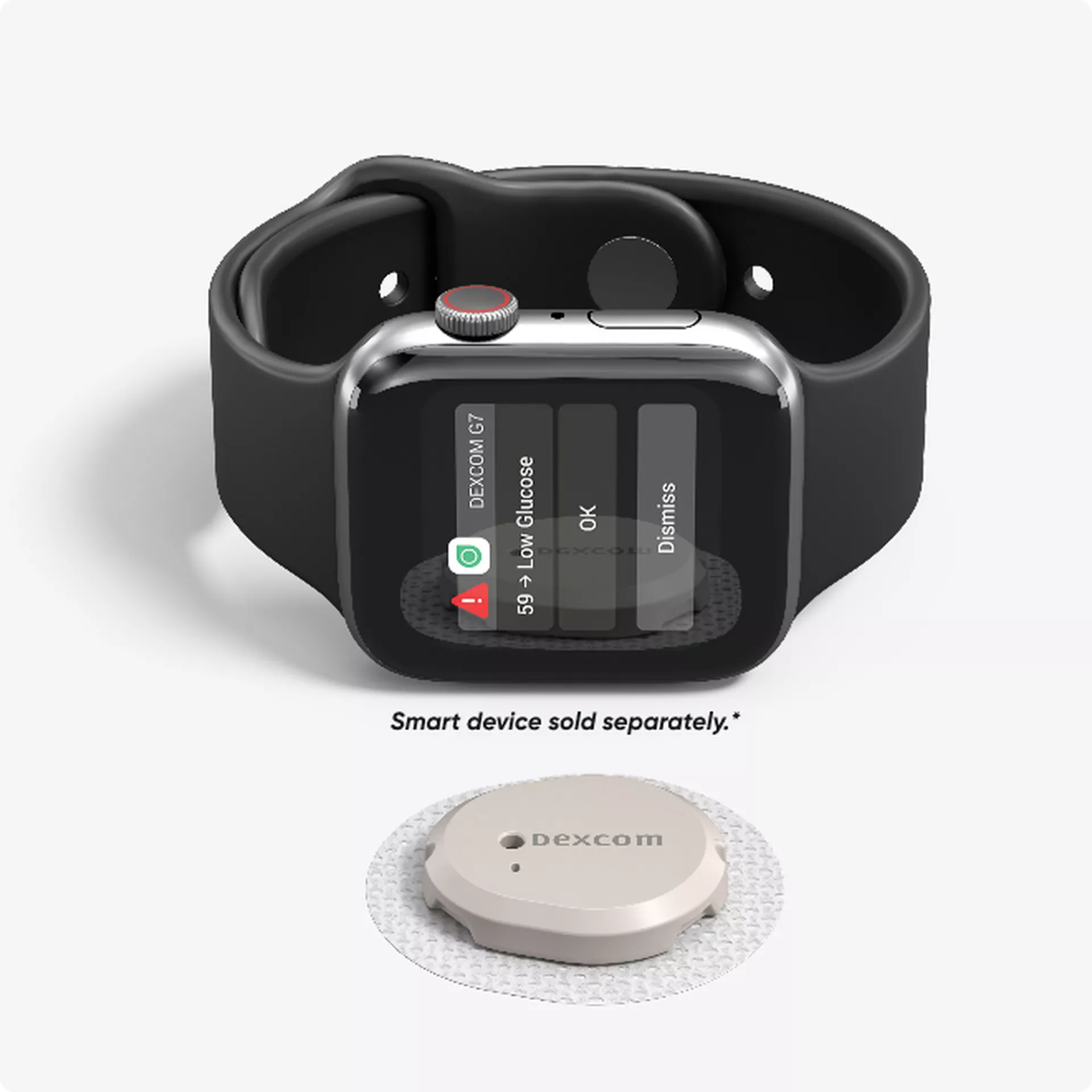 Dexcom G7 sensor alert on a smartwatch, with OK and Dismiss buttons of equal weight.